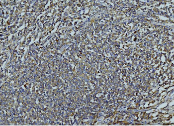 MMP9 Antibody