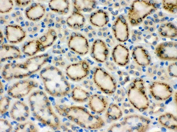 MMP9 Rabbit Polyclonal Antibody