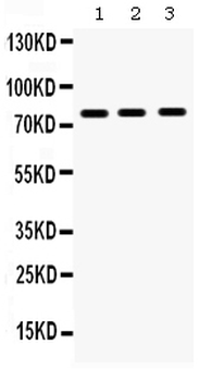 MMP9 Rabbit Polyclonal Antibody