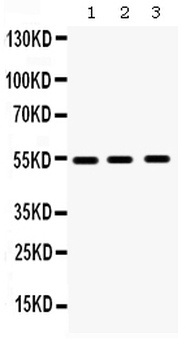 MMP10 Rabbit Polyclonal Antibody