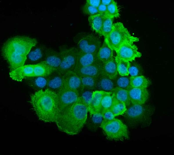 S100 alpha 6/S100A6 Antibody