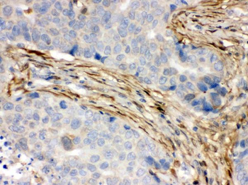 S100 alpha 6/S100A6 Antibody
