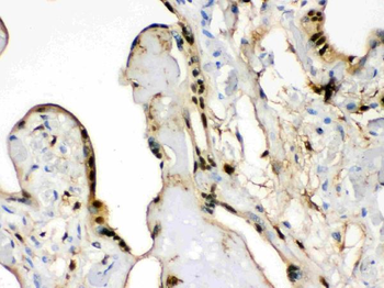 S100 alpha 6/S100A6 Antibody