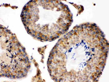 S100 alpha 6/S100A6 Antibody