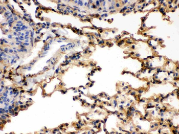 S100 alpha 6/S100A6 Antibody