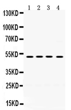 TIM 1/HAVCR1 Rabbit Polyclonal Antibody