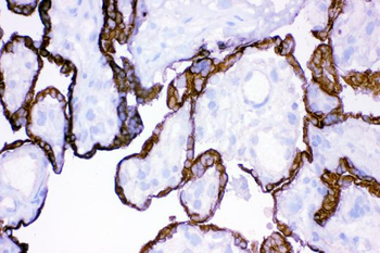 HSD11B2 Antibody