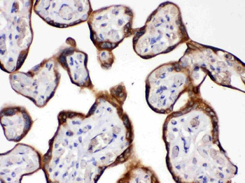 HSD11B2 Antibody