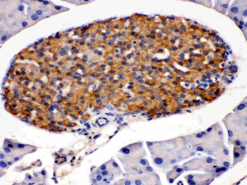 HSD11B2 Antibody