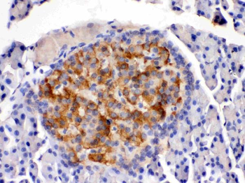 HSD11B2 Antibody