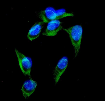 GRK3/ADRBK2 Rabbit Polyclonal Antibody