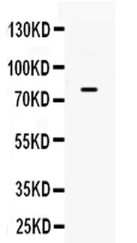 GRK3/ADRBK2 Rabbit Polyclonal Antibody