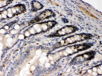 AIM2 Rabbit Polyclonal Antibody