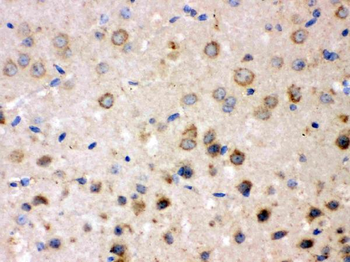 FE65/APBB1 Rabbit Polyclonal Antibody