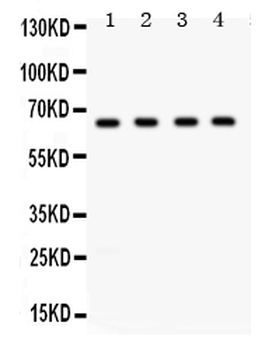 FE65/APBB1 Rabbit Polyclonal Antibody