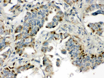 BMP5 Rabbit Polyclonal Antibody