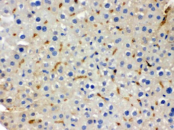 BMP5 Rabbit Polyclonal Antibody