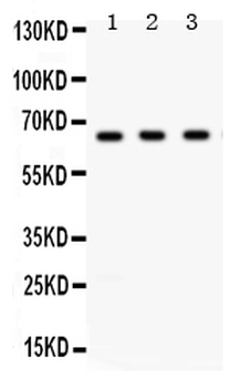 Chk2/CHEK2 Rabbit Polyclonal Antibody