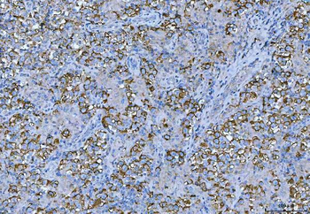 FMRP/FMR1 Rabbit Polyclonal Antibody