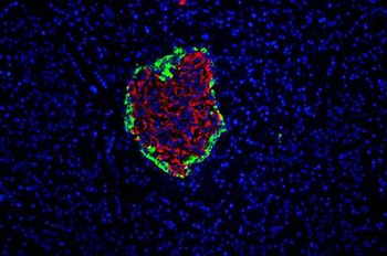 GLP1/GCG Rabbit Polyclonal Antibody