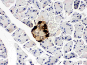 GLP1/GCG Rabbit Polyclonal Antibody