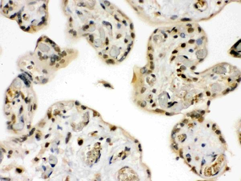 GRK5 Rabbit Polyclonal Antibody