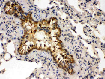 GRK5 Rabbit Polyclonal Antibody