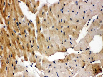 GRK5 Rabbit Polyclonal Antibody