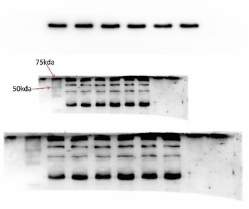 GRK5 Rabbit Polyclonal Antibody