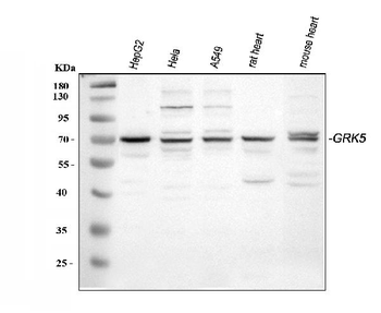 GRK5 Rabbit Polyclonal Antibody