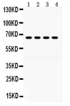 GRK6 Rabbit Polyclonal Antibody