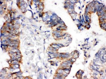 IGFBP3 Rabbit Polyclonal Antibody