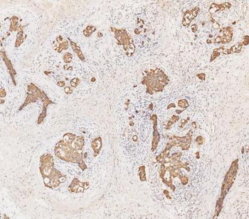 Cytokeratin 19/KRT19 Antibody