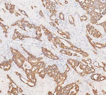 Cytokeratin 19/KRT19 Antibody