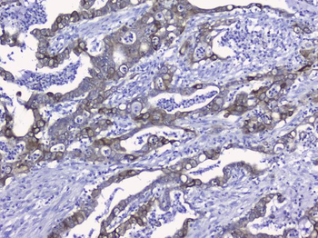 Cytokeratin 19/KRT19 Antibody