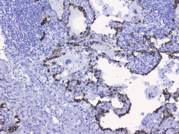 Cytokeratin 19/KRT19 Antibody
