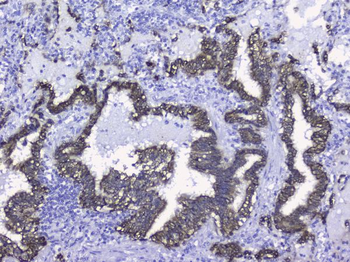 Cytokeratin 19/KRT19 Antibody