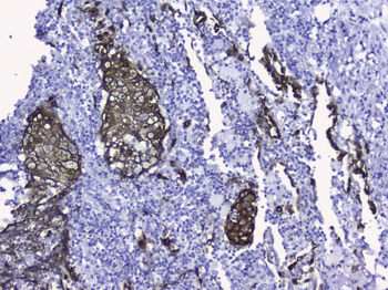 Cytokeratin 19/KRT19 Antibody