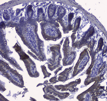 Cytokeratin 19/KRT19 Antibody