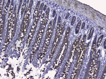 Cytokeratin 19/KRT19 Antibody