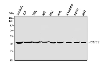 Cytokeratin 19/KRT19 Antibody