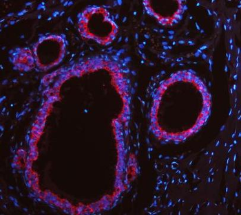 Cytokeratin 19/KRT19 Antibody