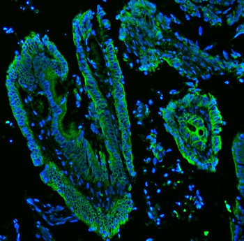 Cytokeratin 19/KRT19 Antibody