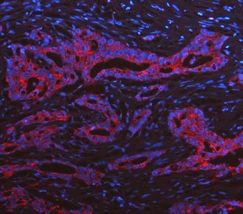 Cytokeratin 19/KRT19 Antibody