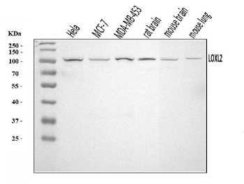 LOXL2 Rabbit Polyclonal Antibody