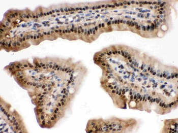 SAPK4/MAPK13 Rabbit Polyclonal Antibody