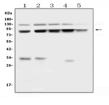 MLH1 Rabbit Polyclonal Antibody