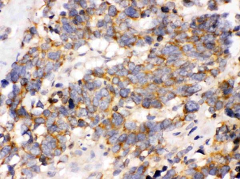 OPA1 Rabbit Polyclonal Antibody