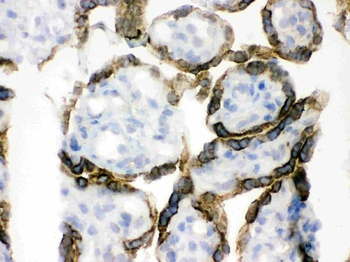PDPK1 Rabbit Polyclonal Antibody