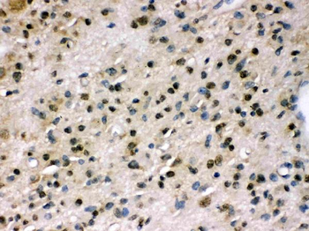 Myosin Phosphatase/PPP1R12A Antibody